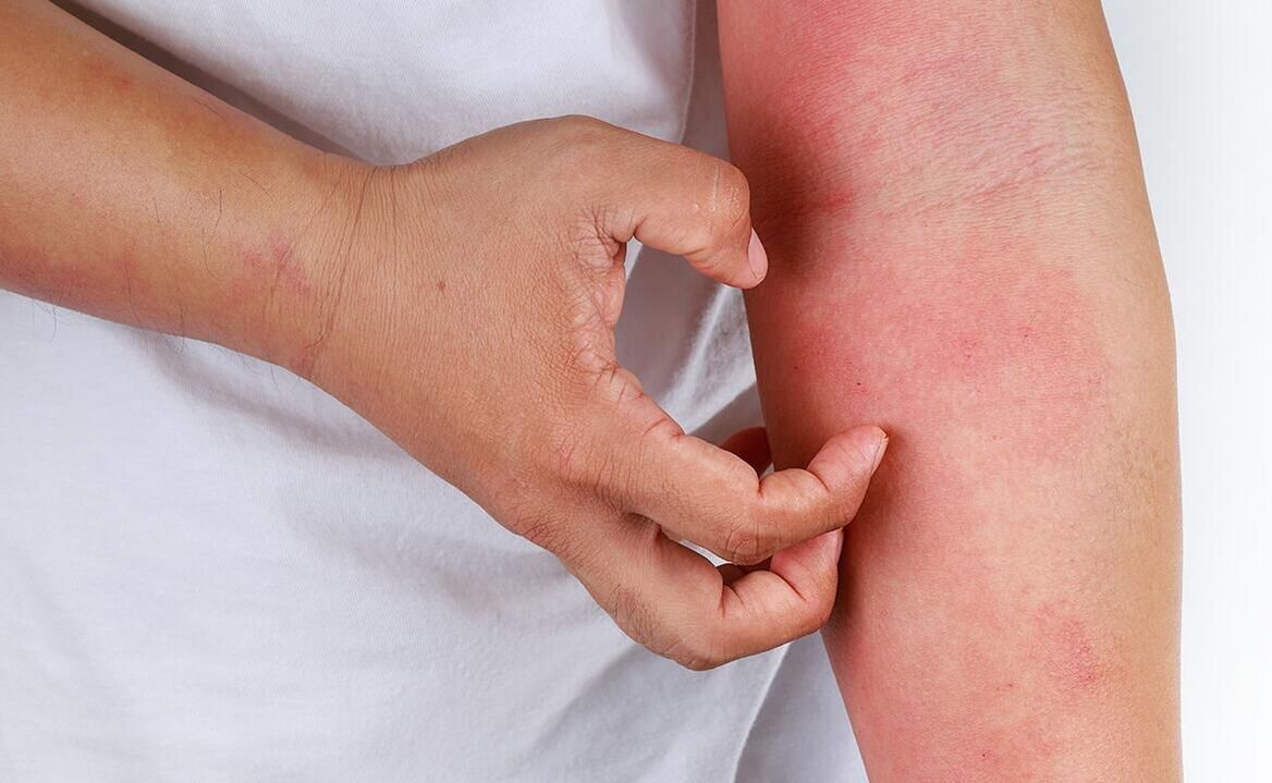 sodali suvdan foydalanish mumkin bo'lgan asoratlar